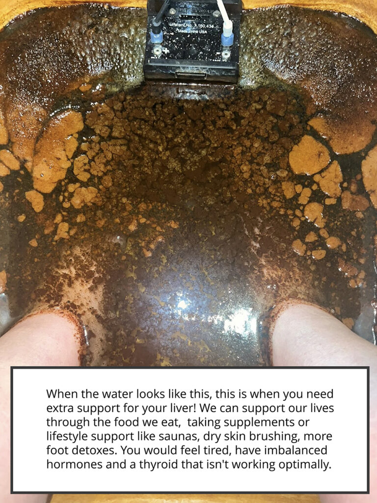 Foot bath results