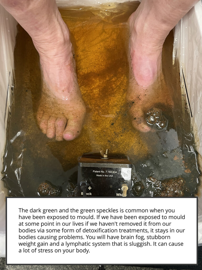Foot bath results